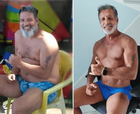 Foto antes e depois de Milton
